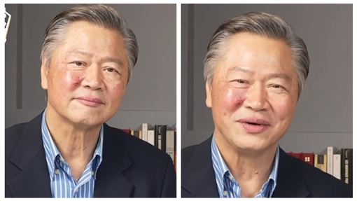 賴岳謙"臉長馬蜂窩"　周玉琴急退通告就醫