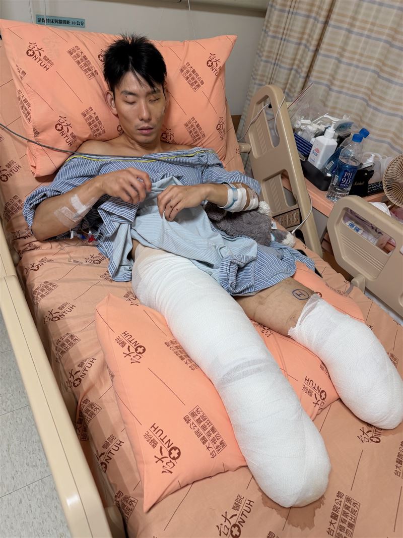 從住院開始,于創宇就很努力想想靠自己完成所有事,「不想麻煩」別人,是他讓自己身心快速恢復的主因