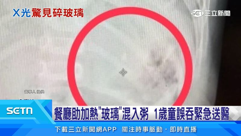 女童胃裡被發現有玻璃碎片。(圖/當事人提供)