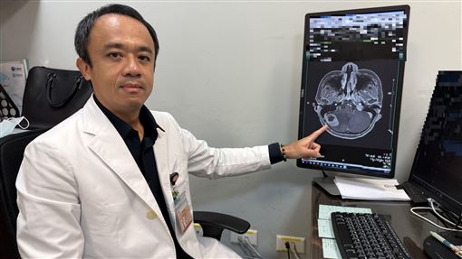 乳癌婦頭暈嘔吐以為副作用　竟是小腦長瘤