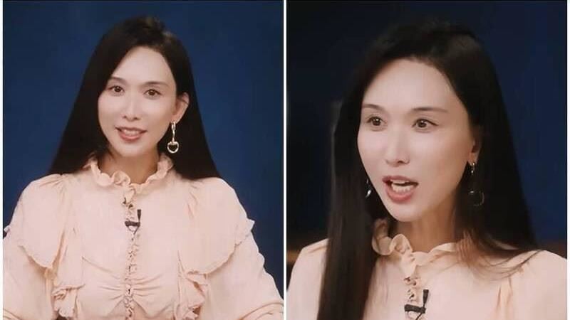 51歲林志玲素顏網認不出來　整形醫揭主因