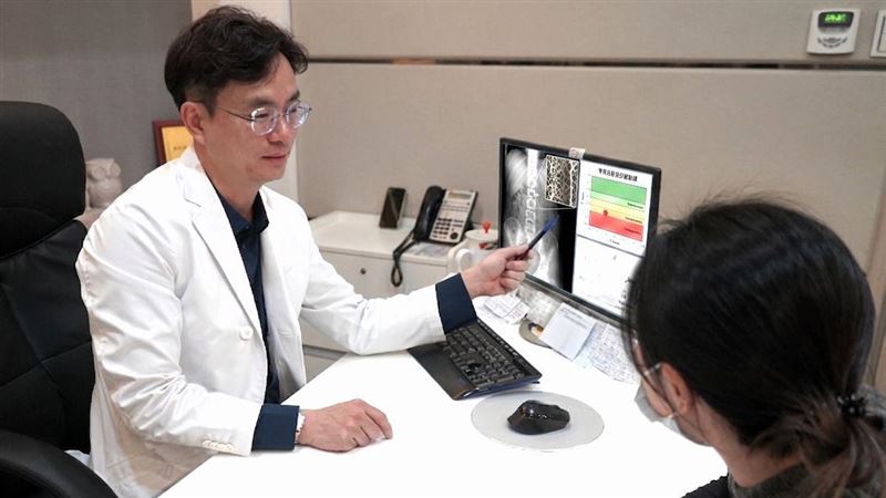 50歲台女性每10人1骨鬆　醫揭5高風險族群