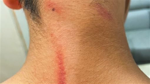 刺頸案爆黑料！遭控霸凌未通報…校方發聲