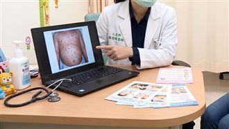畫面曝！男童染腸病毒竟「零發燒」