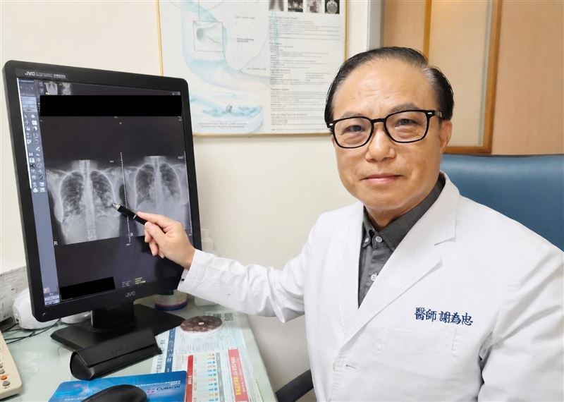 謝為忠提醒,肺腺癌與多種可治療的驅動基因息息相關,只要透過完整的基因檢測找出對應的標靶藥物,依然有機會獲得極佳的控病效果與長期存活率。(圖/大千醫院提供)