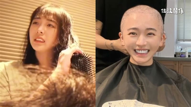 女星乳癌二期剃光長髮　真實模樣曝光