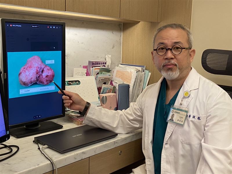 廖敬慈醫師替孕婦順利剖腹產後,立即切除子宮內的15公分大肌瘤。(圖/茂盛醫院提供)