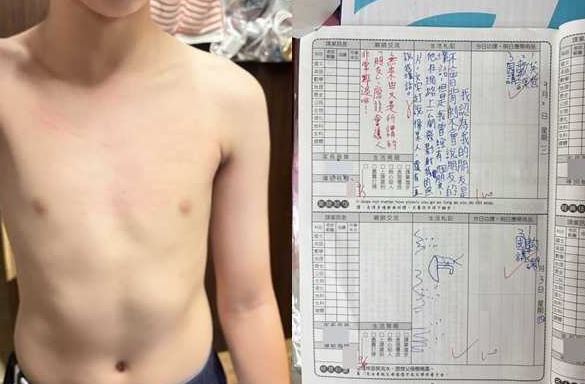 &nbsp;A生曾在聯絡簿向老師反應被欺負，A生家長表示，同學揮刀衝突當天孩子胸口出現明顯抓傷。（圖／民眾提供）