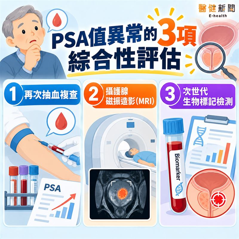 PSA值異常怎麼辦?納入這「3項」綜合性評估。(圖/醫健新聞網提供)