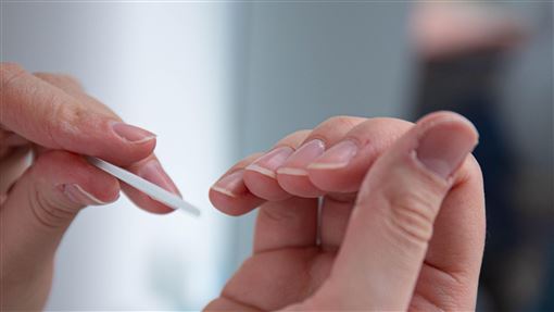 廚房工作竟染「綠甲症」！潮濕環境藏危機