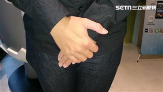 一天3萬步代價太驚人！57歲男尿液變鮮紅