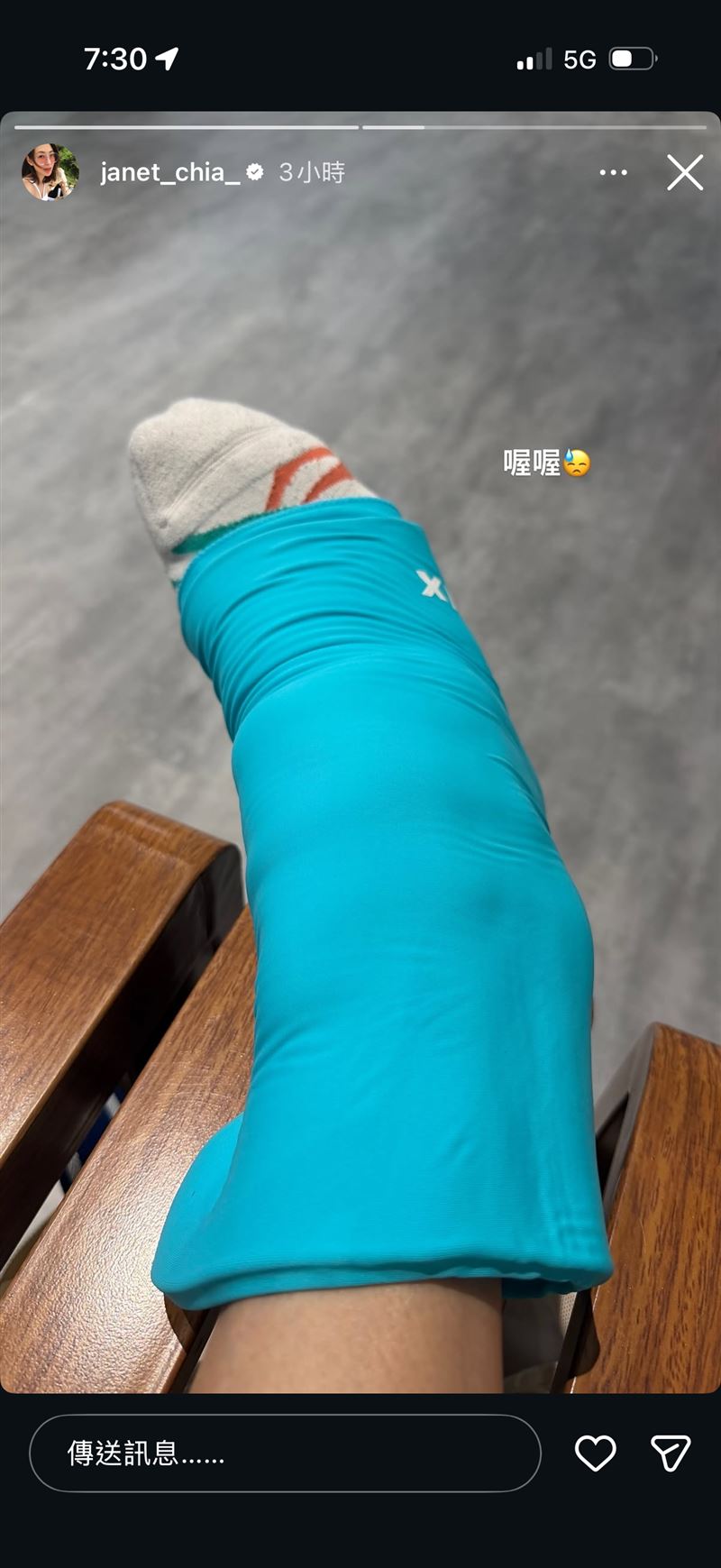 賈永婕國慶日打匹克球不慎扭傷腳,最後帶傷上台。(圖/記者賴俊佑攝影)