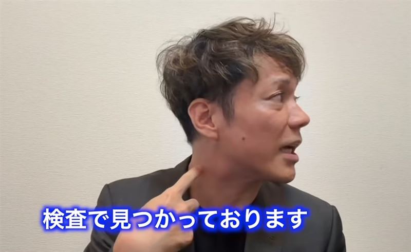 日本搞笑組合「Shampoo Hat」成員恋さん(Koisan)罹患咽喉癌。(圖/翻攝自X平台)