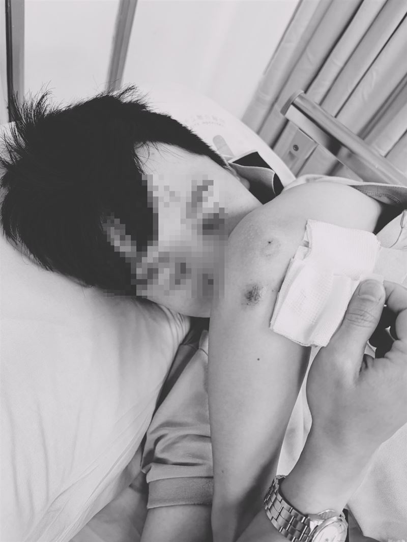 葉元之的助理林姓男子上月16日晚間買宵夜時,不明原因遭到10惡煞包圍並毆打。(圖/當事人提供)