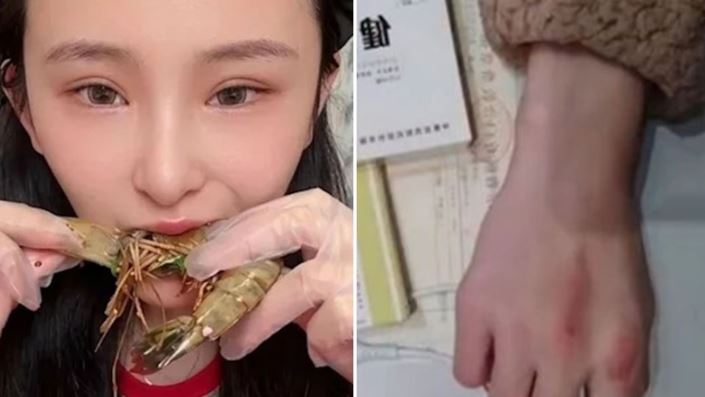 網紅狂吞10kg食物　死前曾問：我沒了怎辦