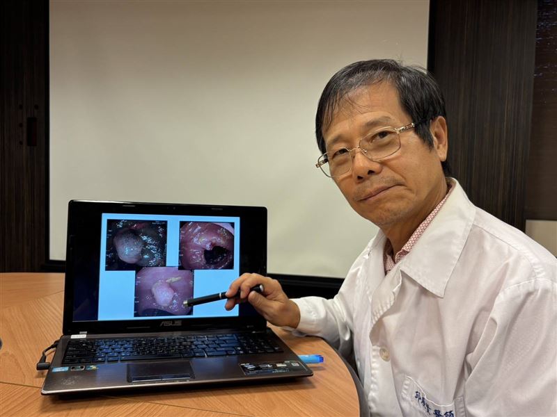 醫師表示,有大腸癌家族史會提高罹癌的可能外,有發生過大腸息肉也要當心,有些類型的息肉有癌化的可能。(圖/書田診所提供)
