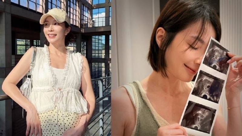 43歲湘瑩懷雙胞胎　孕晚期3症狀纏身