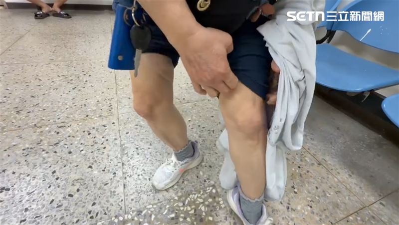 褲管下藏著的是多次手術的痕跡，接下來的人生，她少了丈夫郭男的陪伴，需要更堅強對抗病魔。（圖／記者林昱孜攝影）