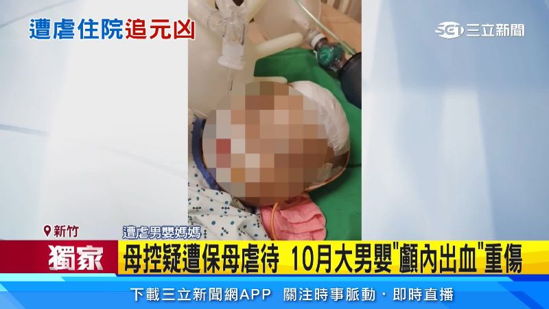 10月大男嬰顱內出血重傷