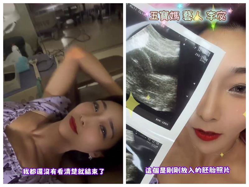 李宓植入胚胎。（圖／翻攝自李宓臉書）