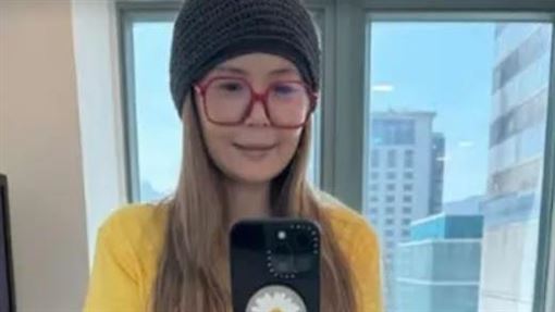 大咖女星暴瘦成紙片人　曾因類固醇腫一圈