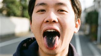 6旬男刷牙驚見舌頭冒「黑森林」 醫揭真凶